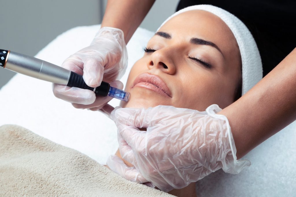 Microneedling with mesotherapy